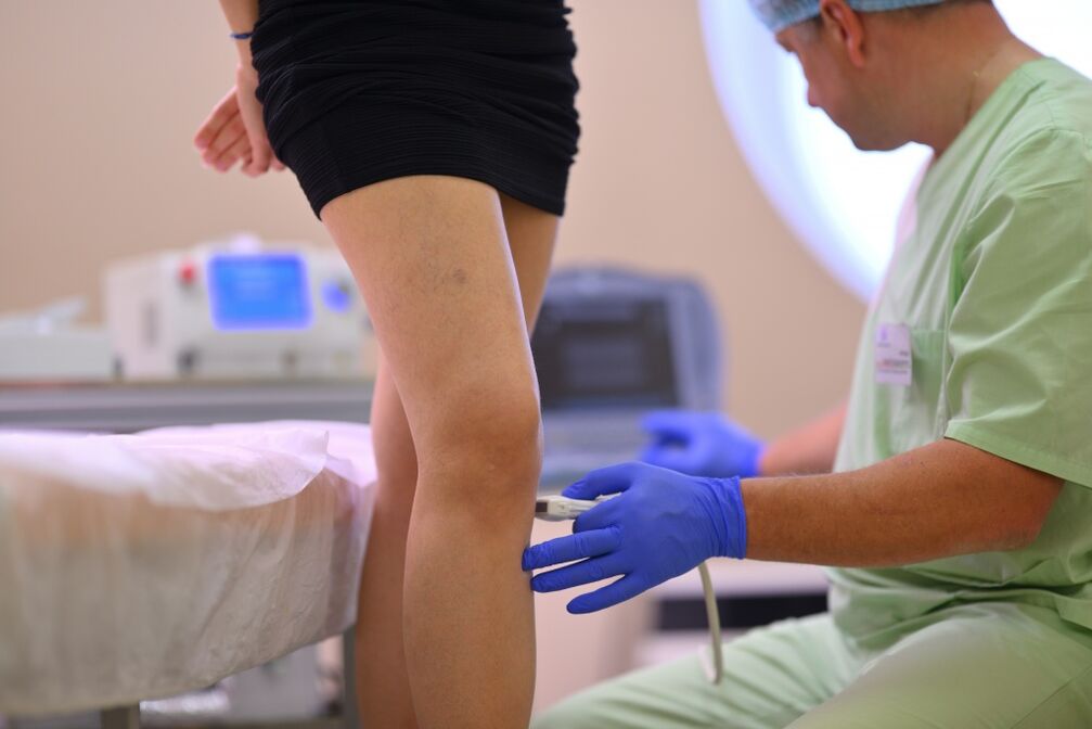 traitement des varices dans les jambes