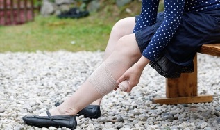 Les symptômes des varices dans les jambes chez les femmes. 